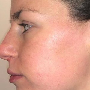 After - <strong>Estremamente soddisfatta!</strong>