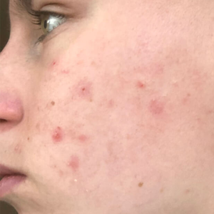 Before - <strong>Estremamente soddisfatta!</strong>