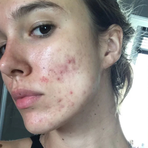 Before - <strong>Ottimo prodotto!</strong>