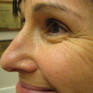 Before - <strong>Risultati incredibili!</strong>