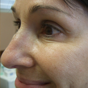 After - <strong>Risultati incredibili!</strong>