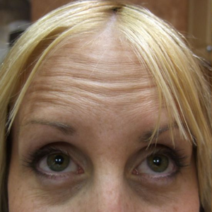 Before - <strong>Anche io allego il mio prima e dopo!</strong>