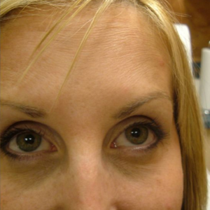 After - <strong>Anche io allego il mio prima e dopo!</strong>