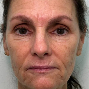 Before - <strong>Ero molto titubante!</strong>