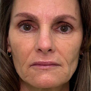 After - <strong>Ero molto titubante!</strong>