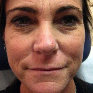 Before - <strong>Mi sono trovata benissimo!</strong>