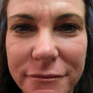 After - <strong>Mi sono trovata benissimo!</strong>